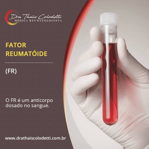 Fator Reumatóide - 1 (1)
